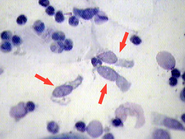 Мазок из уретры