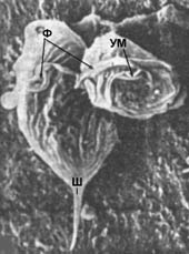 Трихомонады на электронной фотографии